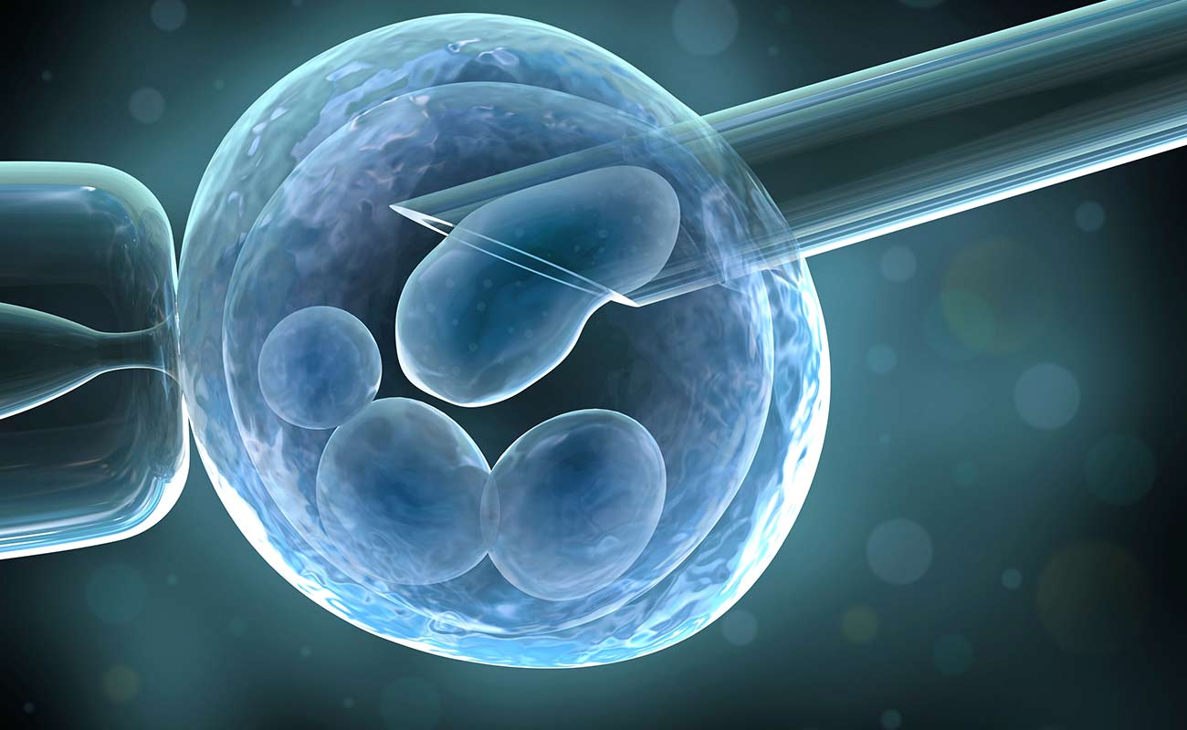 درمان ناباروری با IVF  